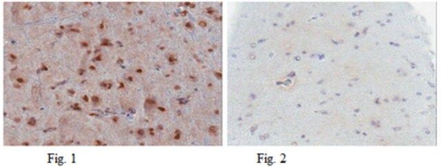 Anti-p53 (wild type) Antibody, clone PAb1620