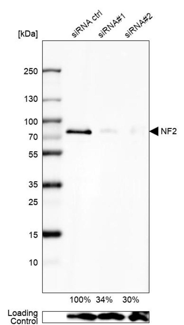 Anti-NF2 antibody produced in rabbit