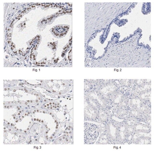 Anti-P40 Antibody, clone 11F12.1