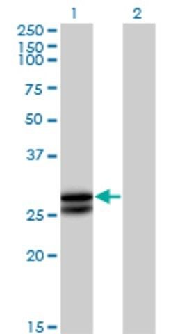 Anti-OSM antibody produced in mouse