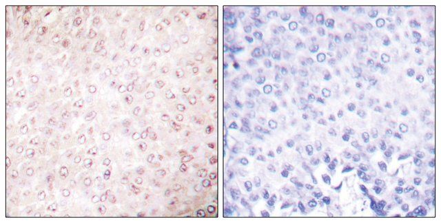 Anti-P300 antibody produced in rabbit