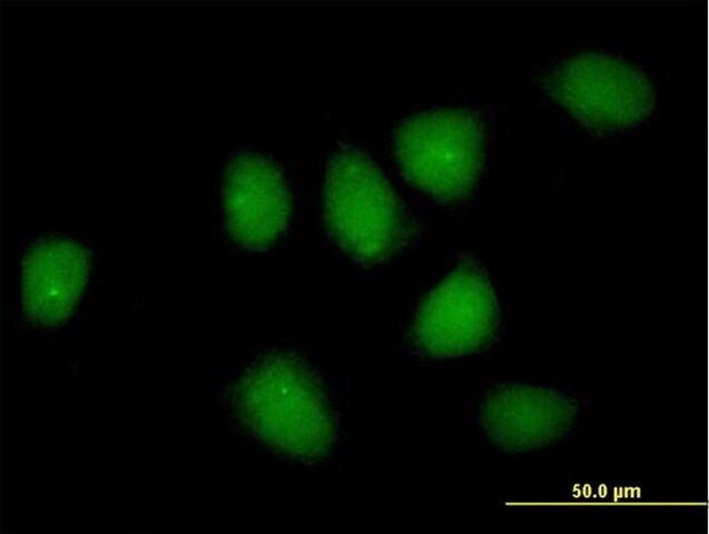 Anti-NR3C1 antibody produced in rabbit