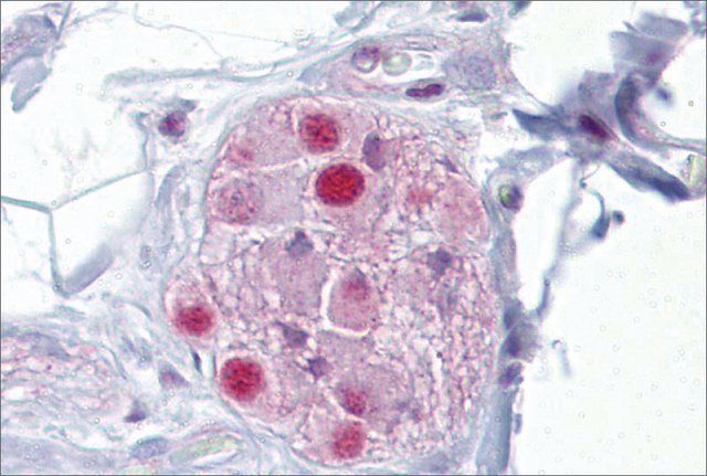 Anti-NR3C1 antibody produced in rabbit