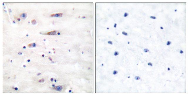 Anti-NMDAR1 antibody produced in rabbit