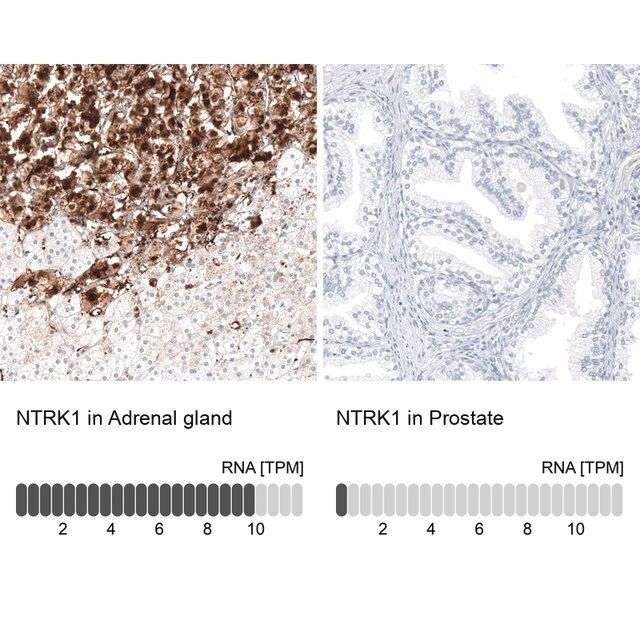 Anti-NTRK1 antibody produced in rabbit