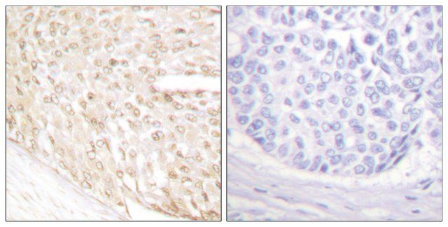 Anti-p18 INK antibody produced in rabbit