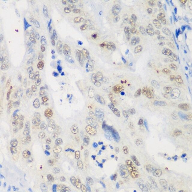 Anti-p53 antibody produced in rabbit