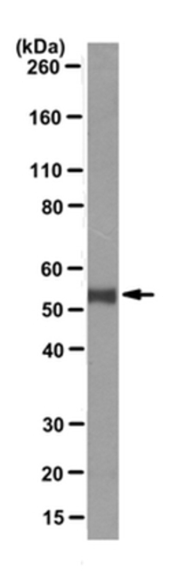 Anti-p53 Antibody, clone PAb421