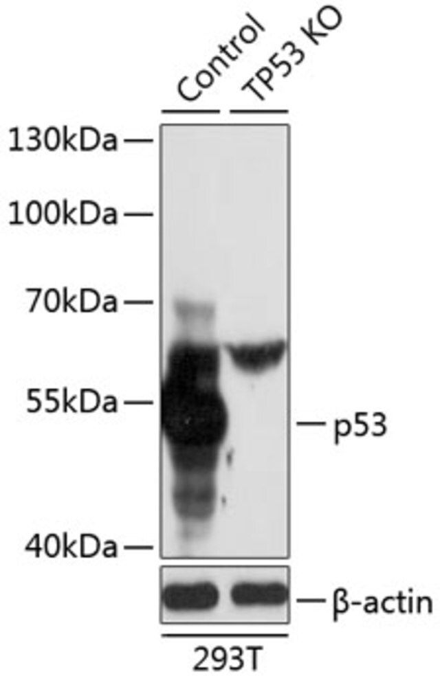 Anti-p53 antibody produced in rabbit