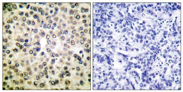 Anti-NF-B p65 antibody produced in rabbit