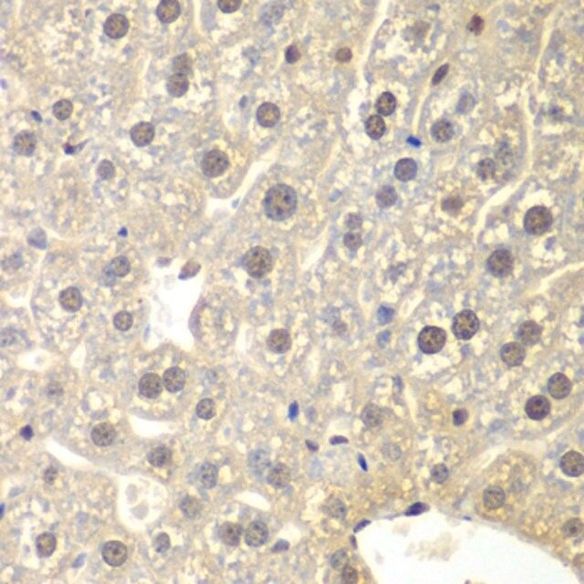 Anti-NR3C1 antibody produced in rabbit