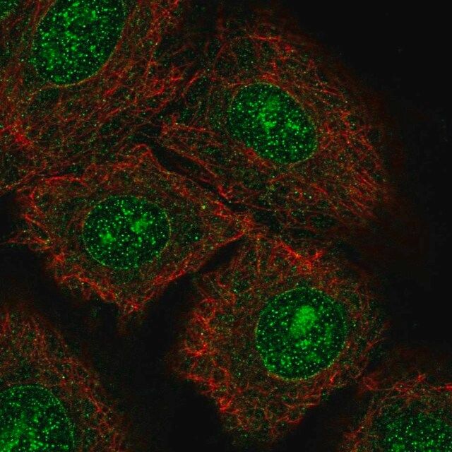 Anti-NTRK3 antibody produced in rabbit