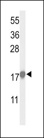 ANTI-P21CIP1 antibody produced in rabbit