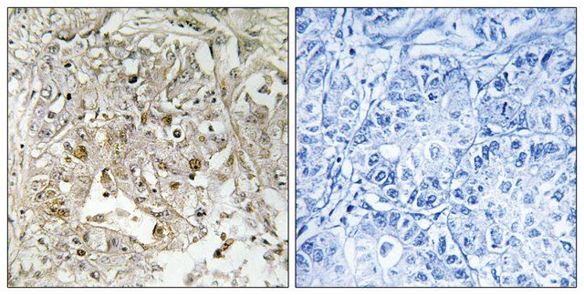 Anti-p38 MAPK antibody produced in rabbit