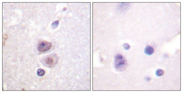 Anti-p38 MAPK antibody produced in rabbit