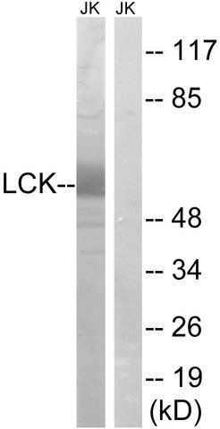 Anti-LCK antibody produced in rabbit