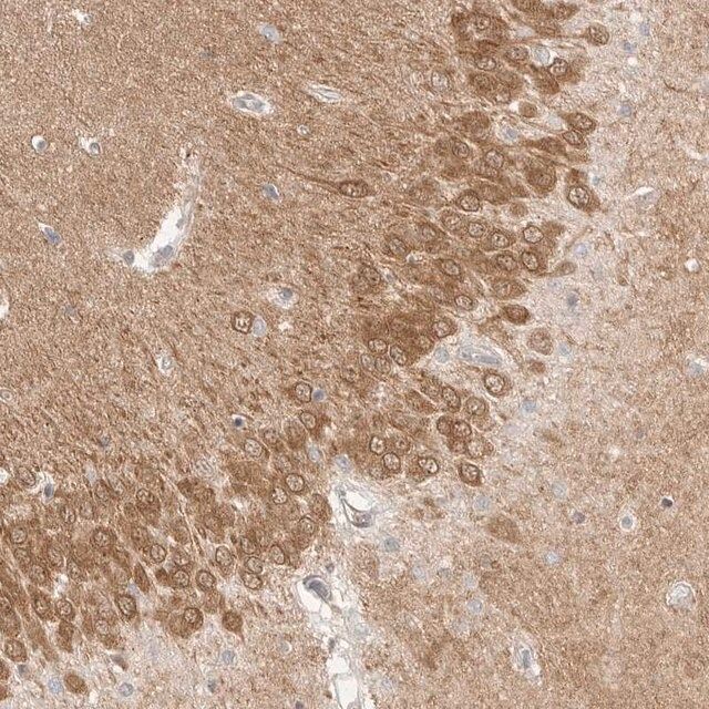 Anti-MAP2K1 antibody produced in rabbit