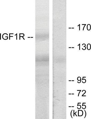 Anti-IGF1R antibody produced in rabbit