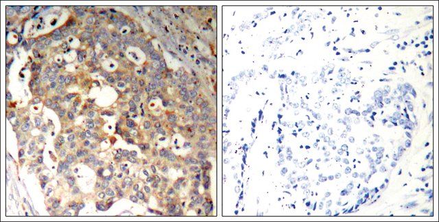 Anti-MAPK9 (Ab-183) antibody produced in rabbit