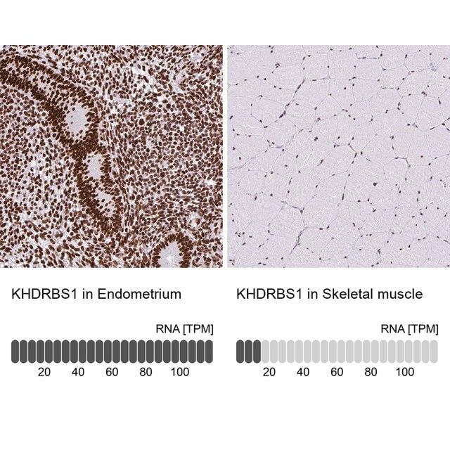 Anti-KHDRBS1 antibody produced in rabbit