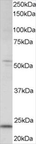 Anti-MAD4/MXD4 antibody produced in goat