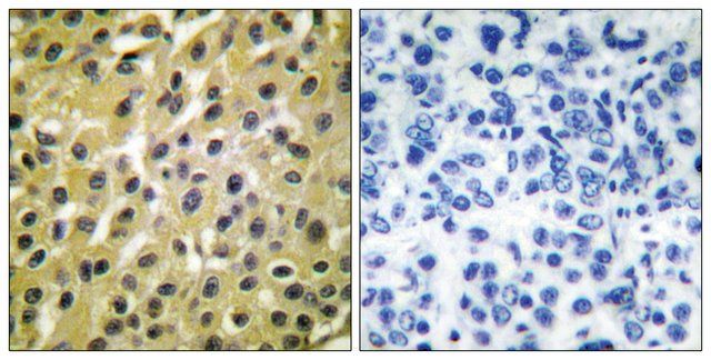 Anti-MDM2 antibody produced in rabbit