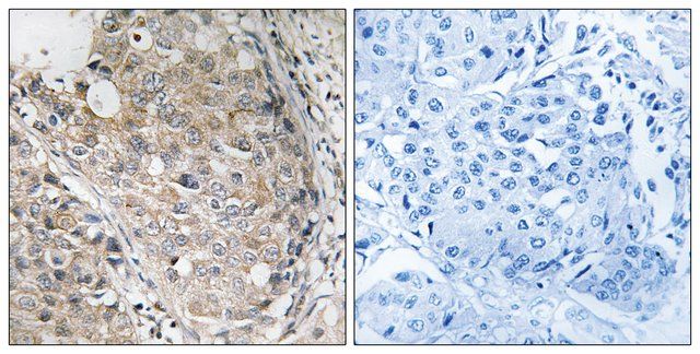 Anti-MKP-1 antibody produced in rabbit