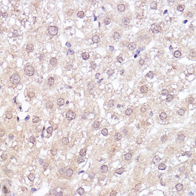 Anti-MEK1 antibody produced in rabbit