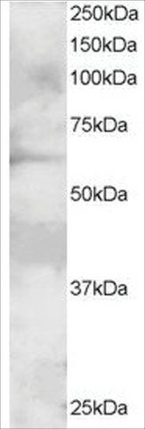 Anti-GRB7, N-Terminal antibody produced in goat