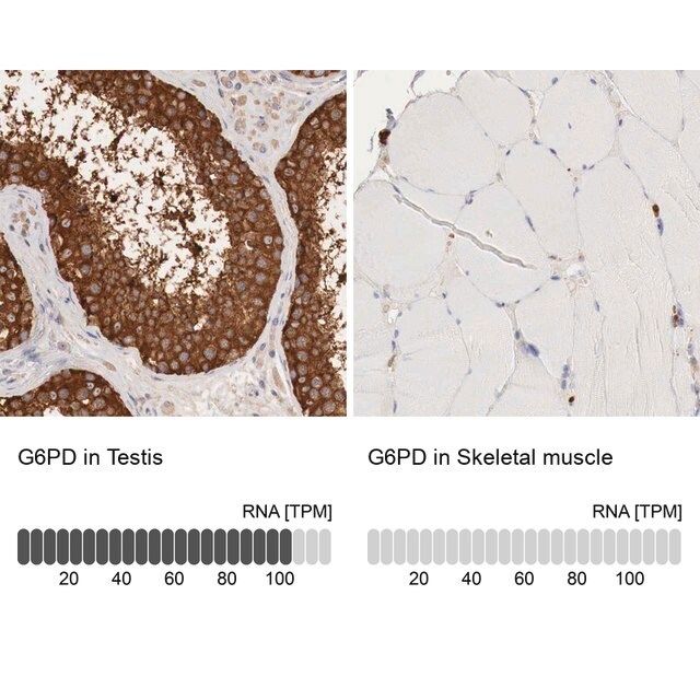 Anti-G6PD antibody produced in rabbit