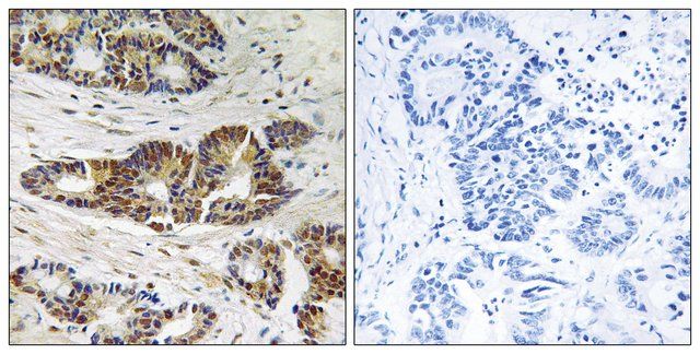 Anti-GRK2 antibody produced in rabbit