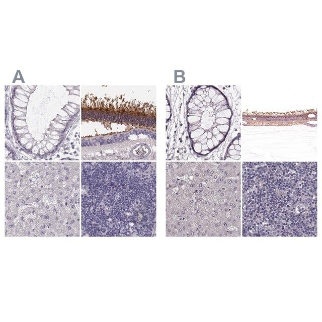 Anti-GRK1 antibody produced in rabbit