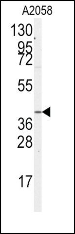 Anti-GNA12 (S67) antibody produced in rabbit