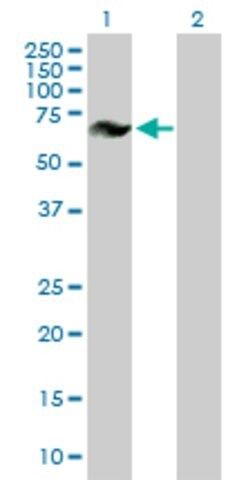 ANTI-GRK6 antibody produced in mouse