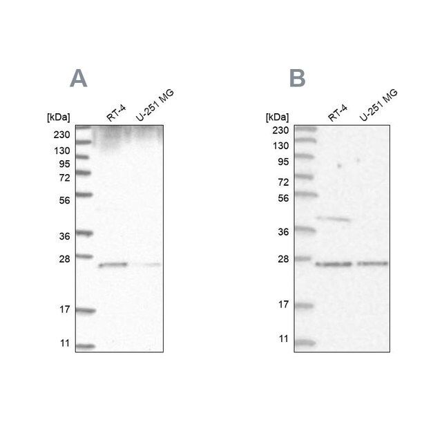 Anti-GRB2 antibody produced in rabbit