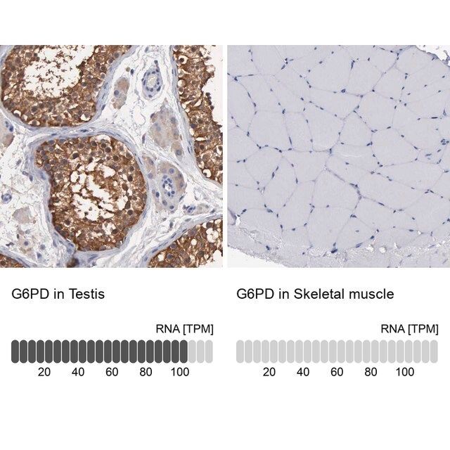 Anti-G6PD antibody produced in rabbit