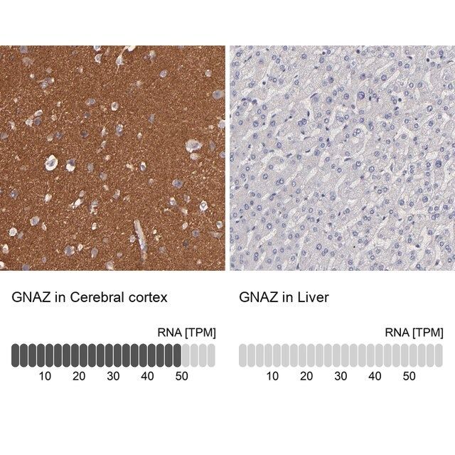 Anti-GNAZ antibody produced in rabbit