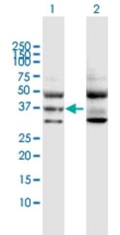 Anti-GNA11 antibody produced in rabbit