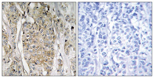 Anti-HER2 antibody produced in rabbit