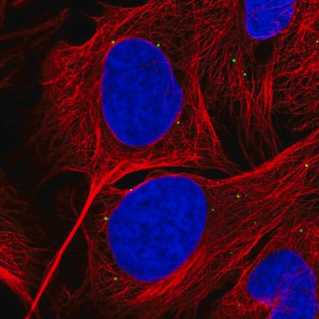 Anti-GRK4 antibody produced in rabbit