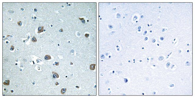 Anti-GNAL antibody produced in rabbit