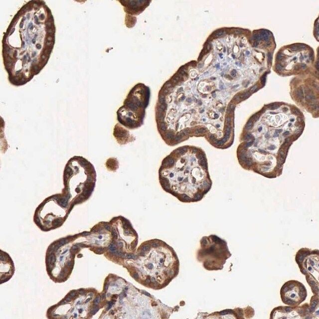 Anti-GPR101 antibody produced in rabbit