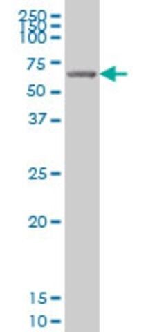 ANTI-GRK6 antibody produced in mouse