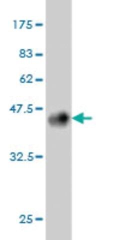 ANTI-GRK6 antibody produced in mouse