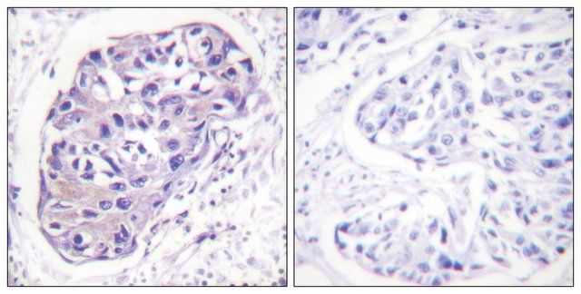 Anti-GRK2 antibody produced in rabbit