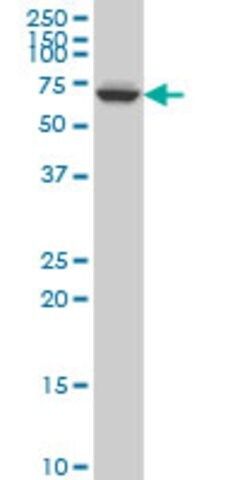 ANTI-GRK6 antibody produced in mouse