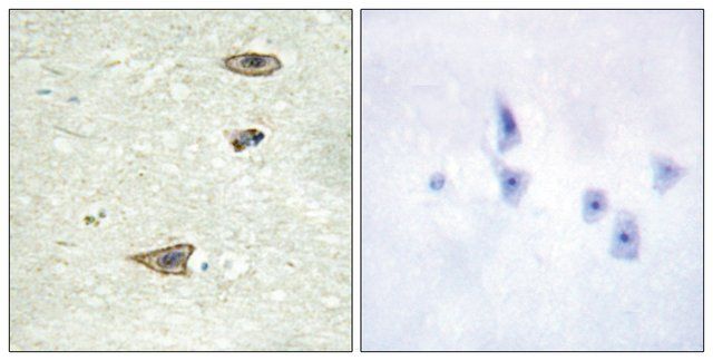 Anti-GRK1 antibody produced in rabbit