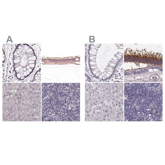 Anti-GRK1 antibody produced in rabbit