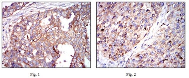 Anti-G6PD Antibody, clone 2H7