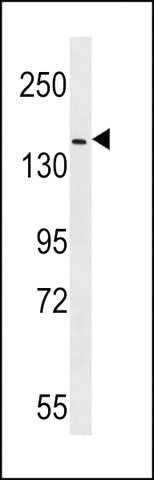 ANTI-HER4 (C-TERM Y1162) antibody produced in rabbit